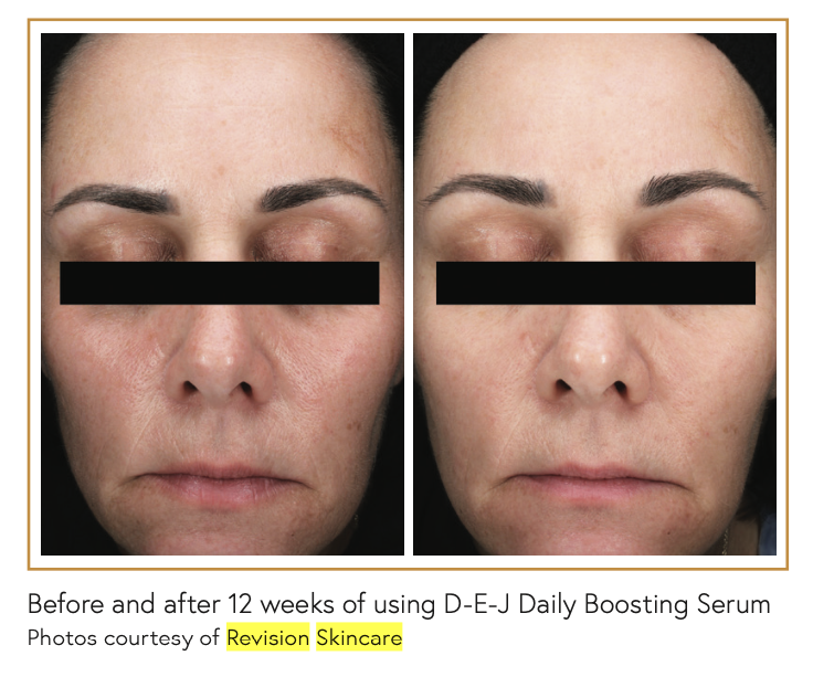 Serum Helps Skin Look and Act Younger | theaestheticguide.com